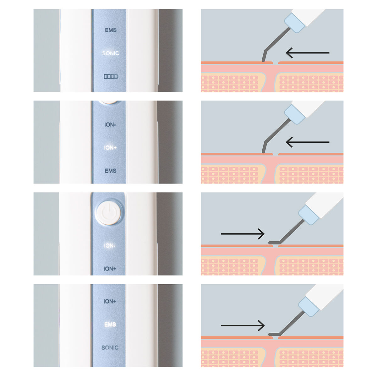 4-in-1-Ultraschall-Gesichtsreiniger Falnik InnovaGoods - AWK Flagship