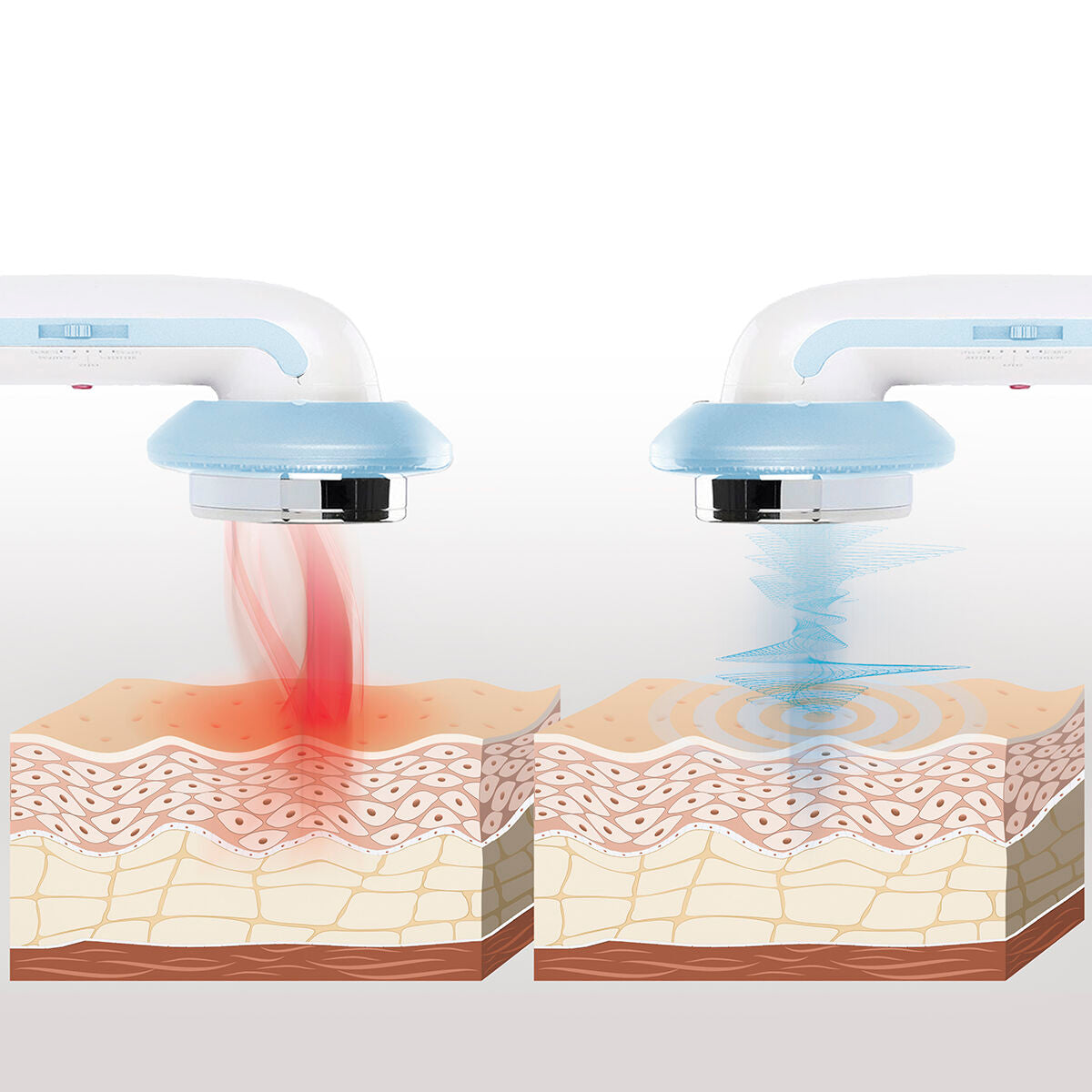 3-in-1 Anti Cellulite Massagegerät mit Ultraschall-Kavitation, Infrarot und Elektrostimulation CellyMax InnovaGoods - AWK Flagship